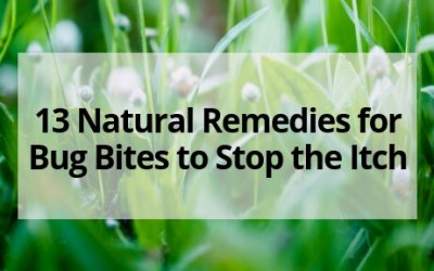 13 Natural Remedies for Bug Bites to Stop the Itch