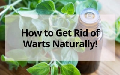 The Easiest Way to Get Rid of Warts Naturally